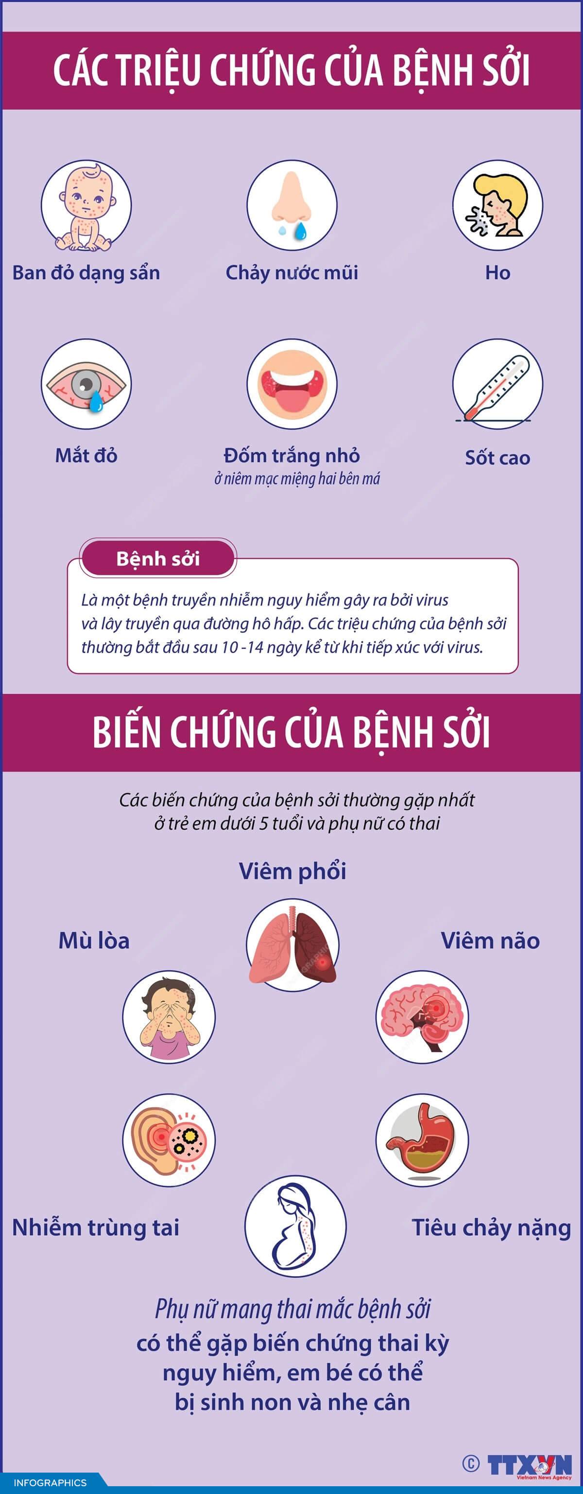 Các triệu chứng của bệnh sởi